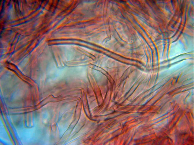 Cerrena hydnoides 10 - Hifas 1